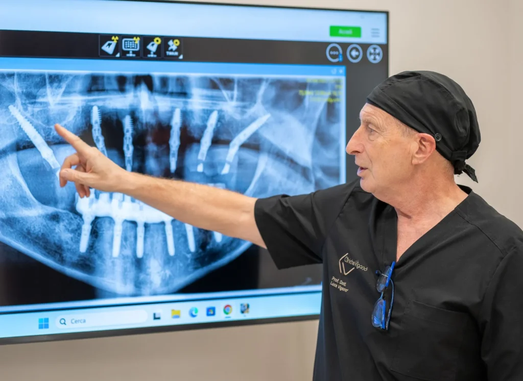 Come si fa un impianto dentale, fumare con impianti dentali