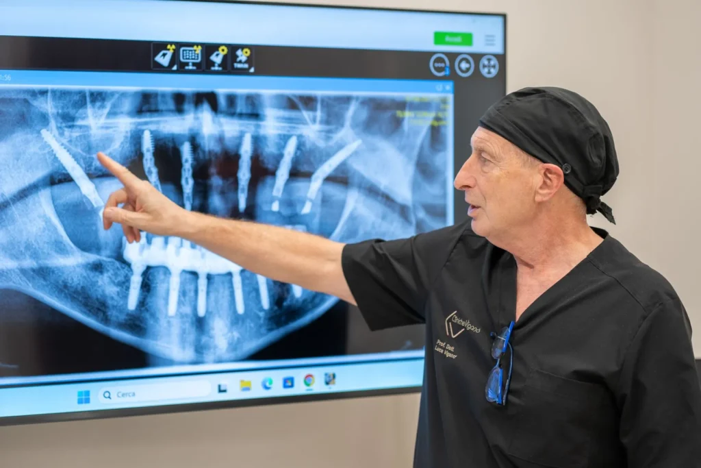 Glossario Implantologia Dentale 3 Impianto dentale a Milano Niguarda, Glossario Implantologia Dentale a Milano Niguarda
